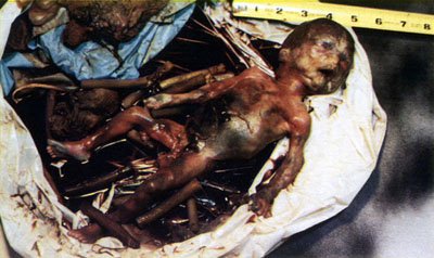 abortedbaby04.jpg