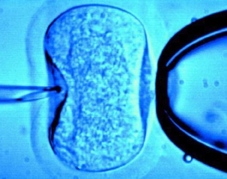 in-vitro-fertilization-procedure.jpg