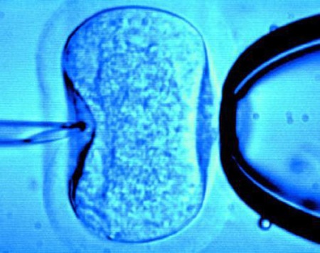 in-vitro-fertilization-procedure.jpg